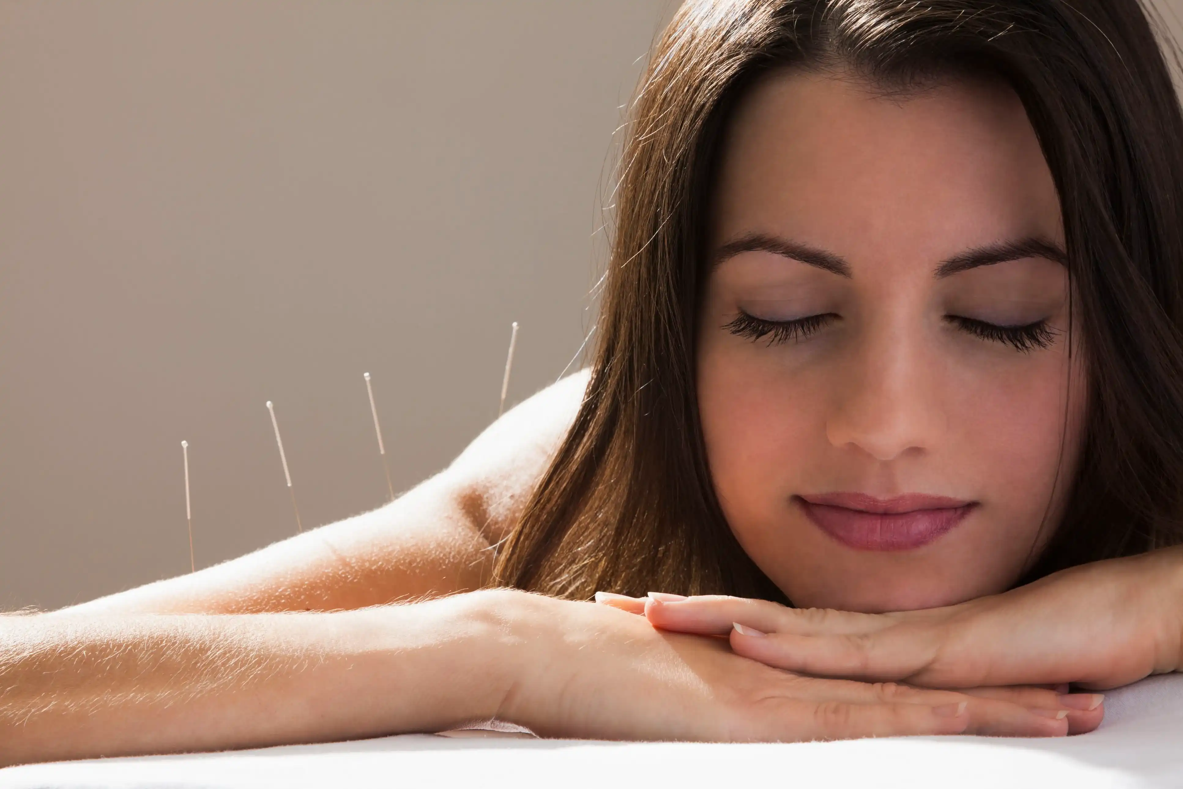 Acupuncture