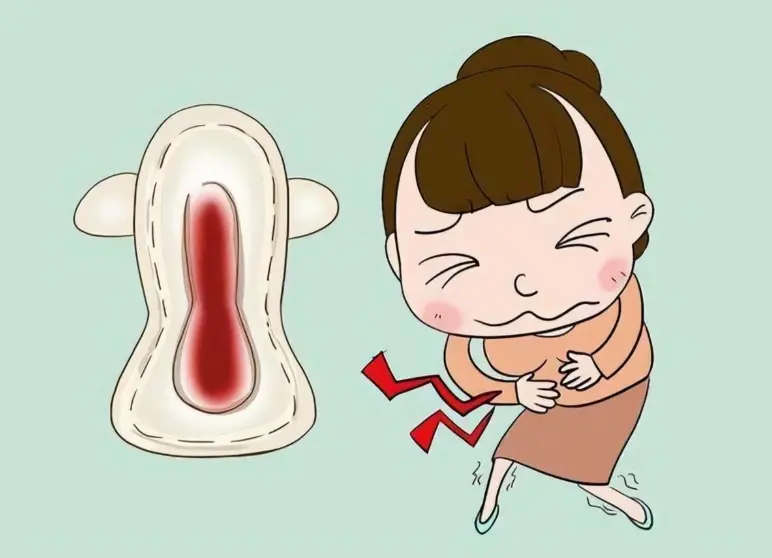 Premenstrual Syndrome causes abdominal cramps Premenstrual Syndrome causes abdominal cramps