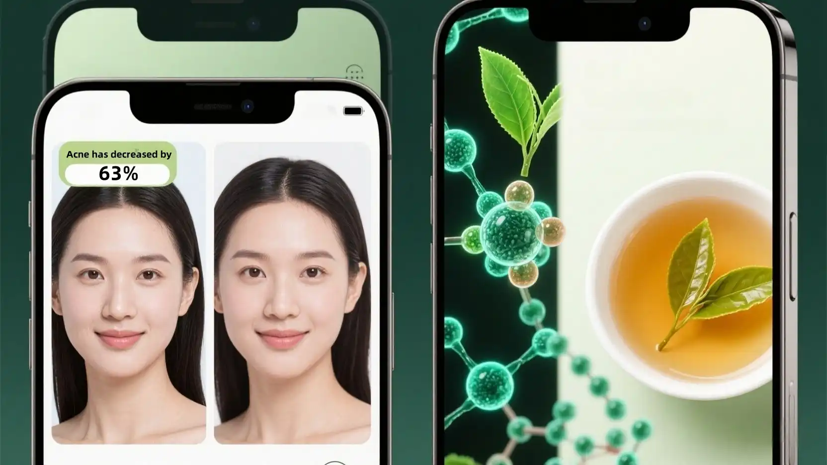Clinical-Backed Acne Reduction with Green Tea Polyphenols