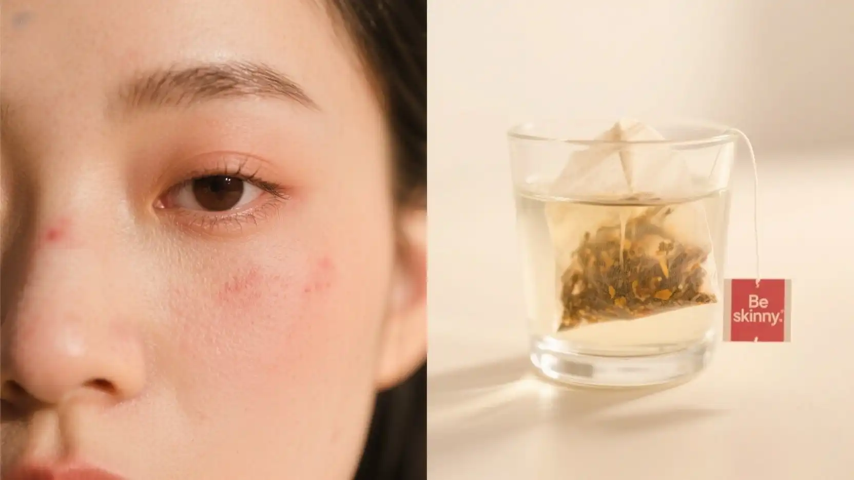 Beauty Tea Calming Irritated Skin