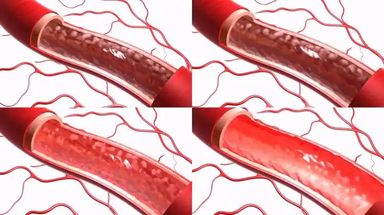 BBl Detox Tea Promotes Vascular Expansion BBl Detox Tea Promotes Vascular Expansion