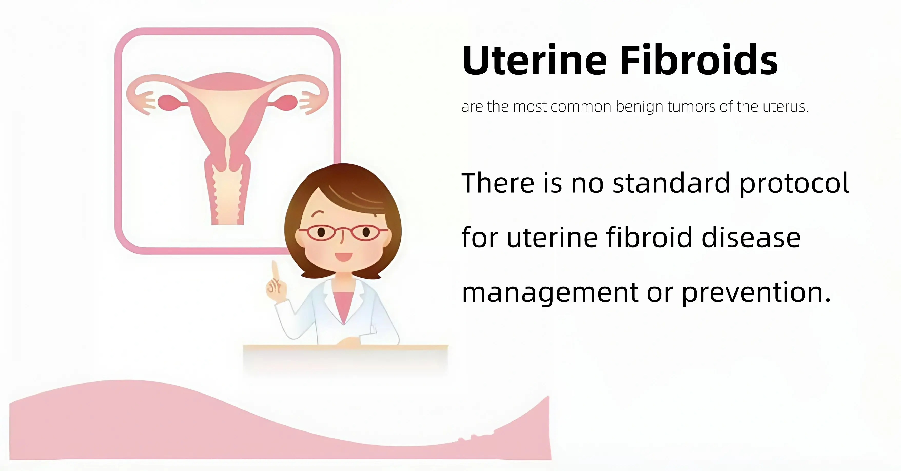 Što je fibroid maternice Što je fibroid maternice