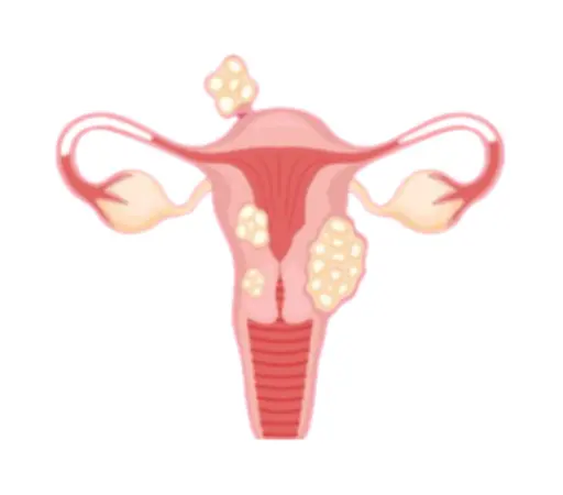 Fibroid Cleanse Tea  User Reviews(2)