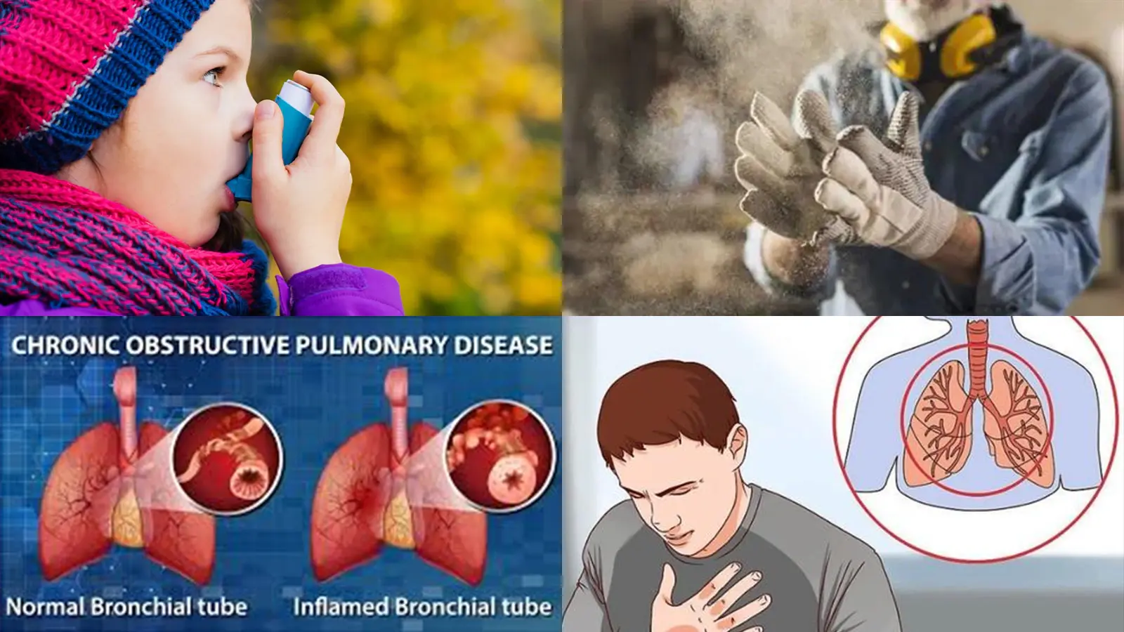 Common lung diseases include asthma, COPD, Interstitial Lung Disease and Pulmonary Sarcoidosis.