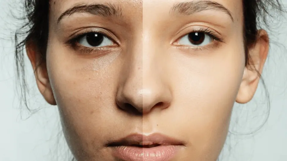 Comparison between dull skin and normal skin