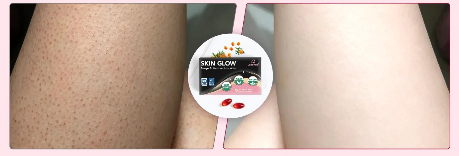 Skin Glow Supplement Alleviates Dry Skin