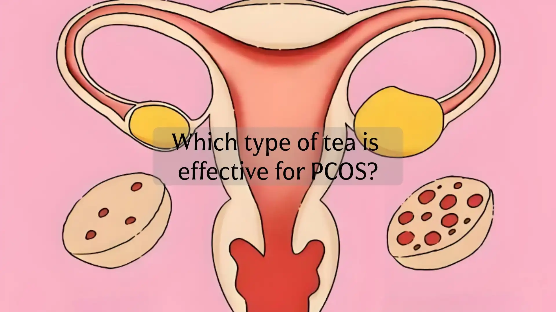 Guide des tisanes pour le SOPK : Menthe verte vs menthe poivrée et autres remèdes à base de plantes